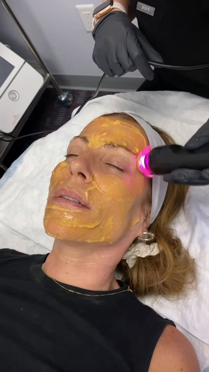 A Glo2 facial handpiece at work on a patient’s temple during an in-office facial at Hudson Aesthetics MD