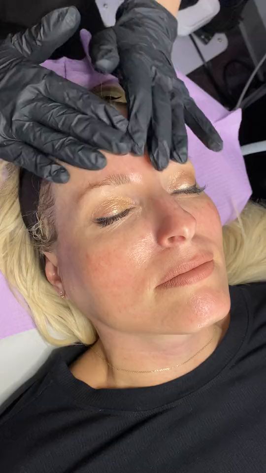 Gloved hands framing a patient’s refreshed, glowing skin after treatment