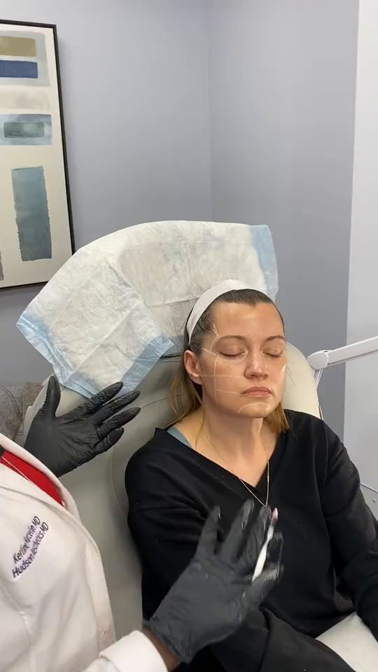 Dr. Kerline Marcelin injecting a patient’s cheek during a Sculptra session