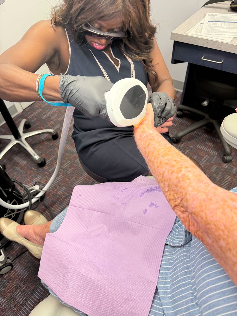 Dr. Kerline Marcelin treating sun damage on a patient’s forearm with Lumecca IPL